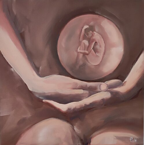 Need care by Chiara Poli, Painting for Sale on Select